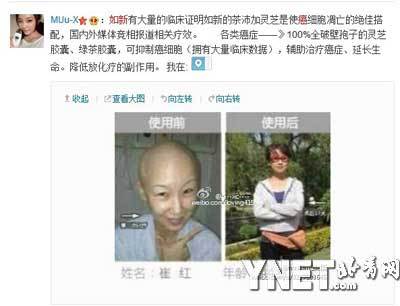 如新華茂產品治療癌癥的“真人事例”